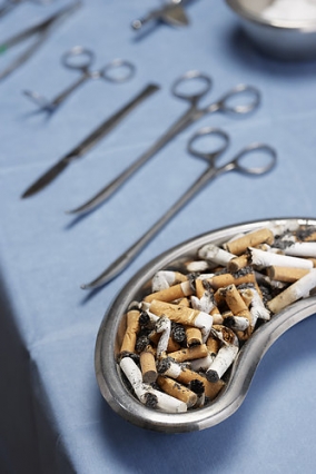 Magyarország világelső a tüdőrák halálozást illetően, rendkívül magas a dohányzással összefüggő megbetegedések és halálesetek száma