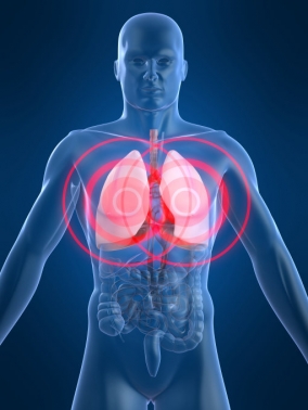 Megbízhatatlan lehet a tüdőrák CT-felvétele
